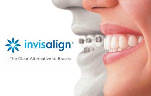 invisalign-logo