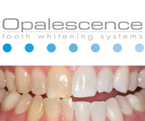 opalescence-1